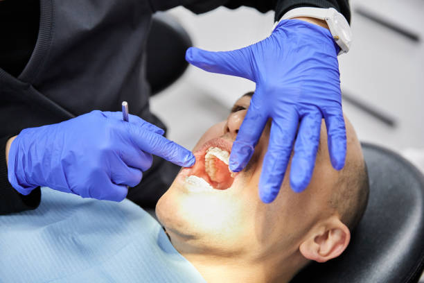 Best Emergency Dental Care for Sports Injuries in Duenweg, MO